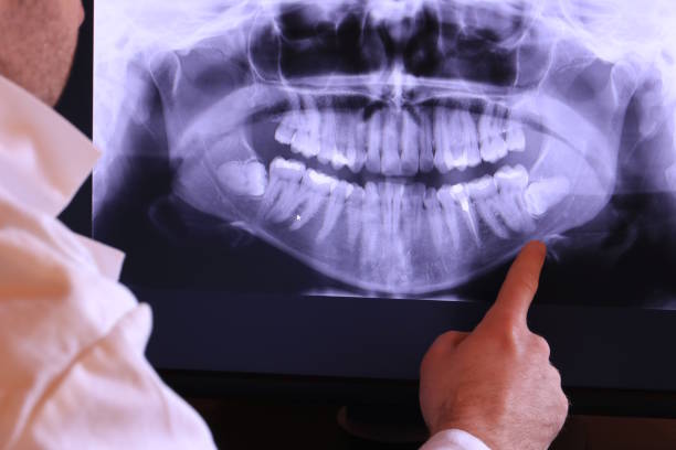 Best Emergency Treatment for Dental Infections or Abscesses in Mcsherrystown, PA
